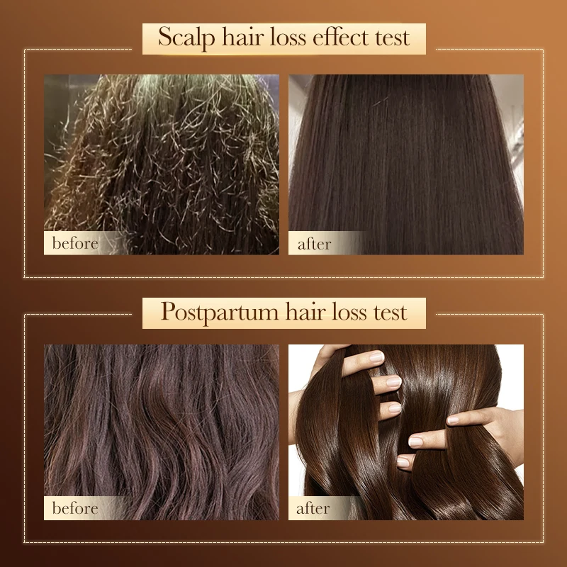 

SADOER Hair Shampoo Moisturized Anti-dandruff Shampoo Strengthen Shampoo Follicles Nourish Roots 500ml Deeply Hair Care W8X0