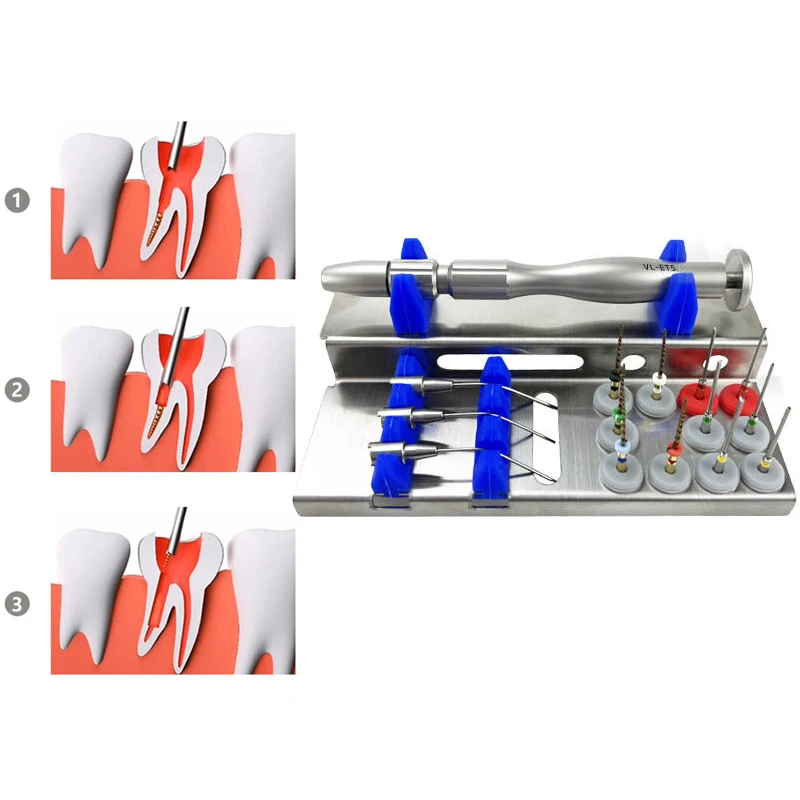 Эндодонтические файлы корневых каналов Denta, экстрактор, система удаления эндофайлов, набор инструментов, оборудование для дайтона, насадки для файлов Niti