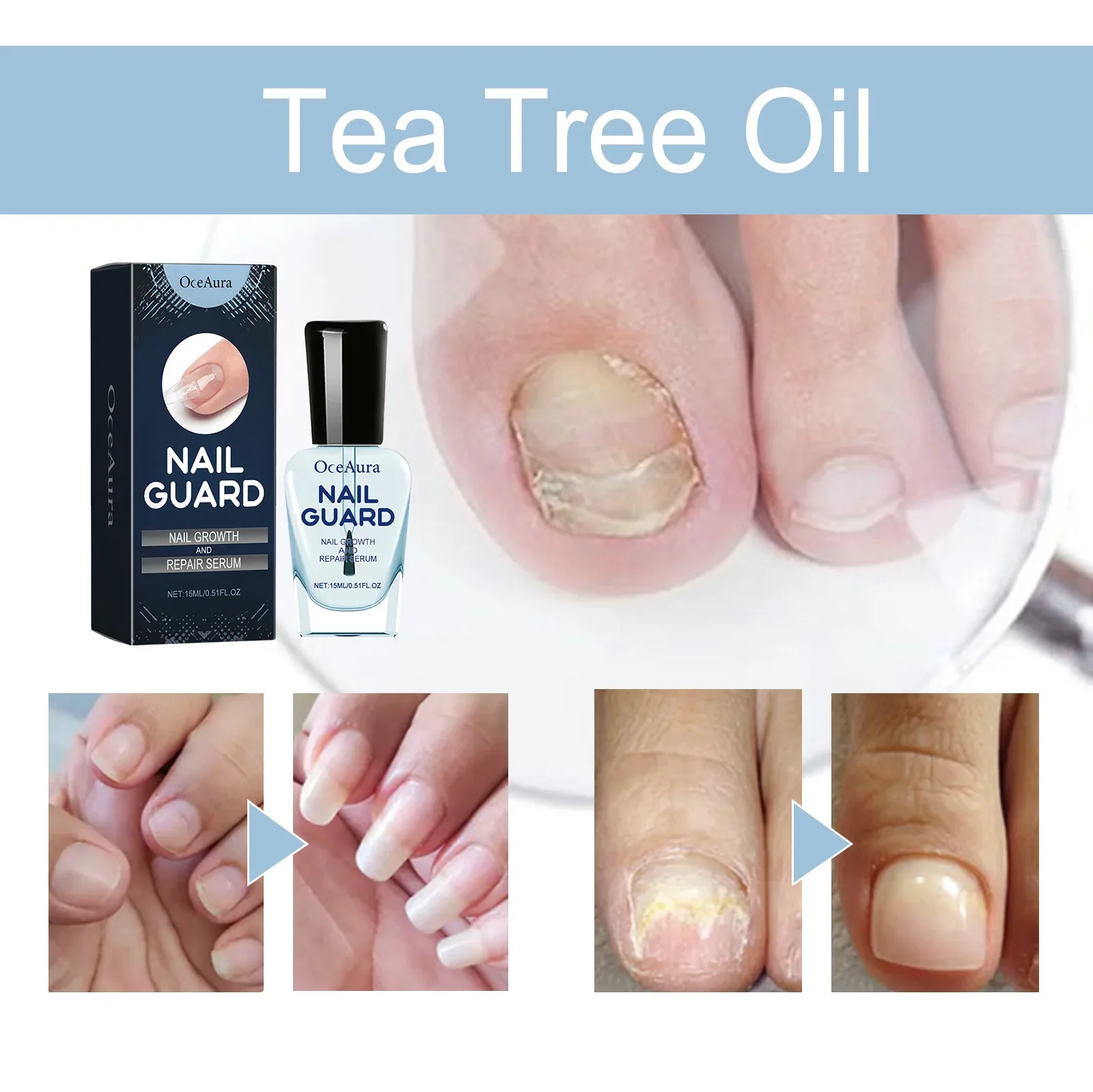 15ml Nail Cuticle Oil Treatment Nail Gel Prevention Agnail Treatment Tool Nourishment Oil Nourish Repair Damaged Nails 네일