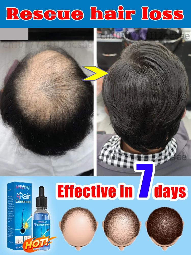 

Moisturizes dry hair Make hair more and more