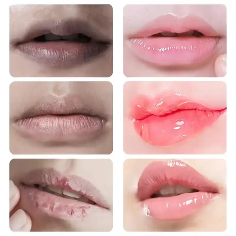 Remove Dark Lip Balm Fast Lightening Pink Lip Exfoliating Fade Lip Line Dead Skin Moisturizer Korean Care Products Beauty Health