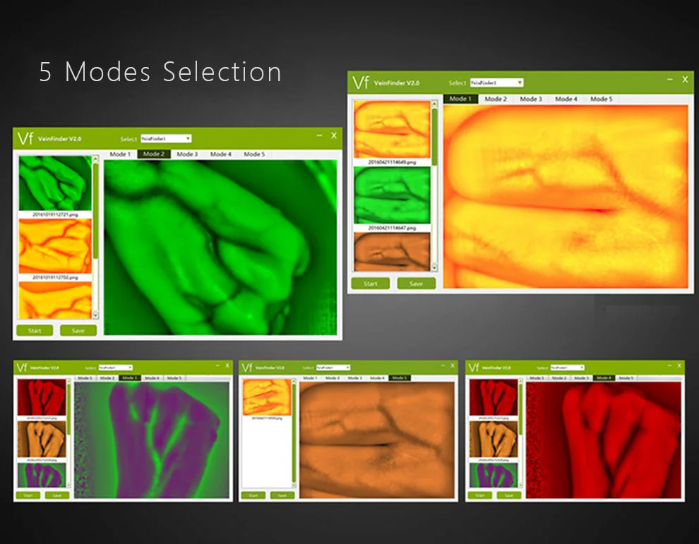 Endoscope Adults Children Suitable Vein Viewer Display Lights Imaging Find Vein Medical Vein Finder Vein Viewer