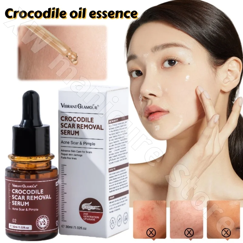 

VIBRANT GLAMOUR Crocodile Oil Essence 30ml Moisturizes Firms Brightens Soothes Repairs Improves Dryness and Darkness
