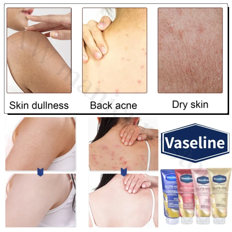 Vaseline Glutamine Whitening Body Lotion Highly Concentrated Niacinamide Hyaluronic Acid Brightens Skin Deeply Hydrating 330ml