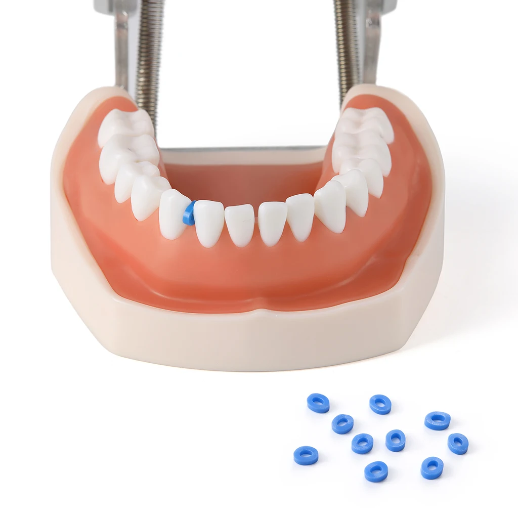 1000 Stück/Packung AZDENT Dental Kieferorthopädische Separatorbänder Elastische Gummibänder Zahnmedizinisches Material zur Erweiterung des Zahnraums – Detail 8