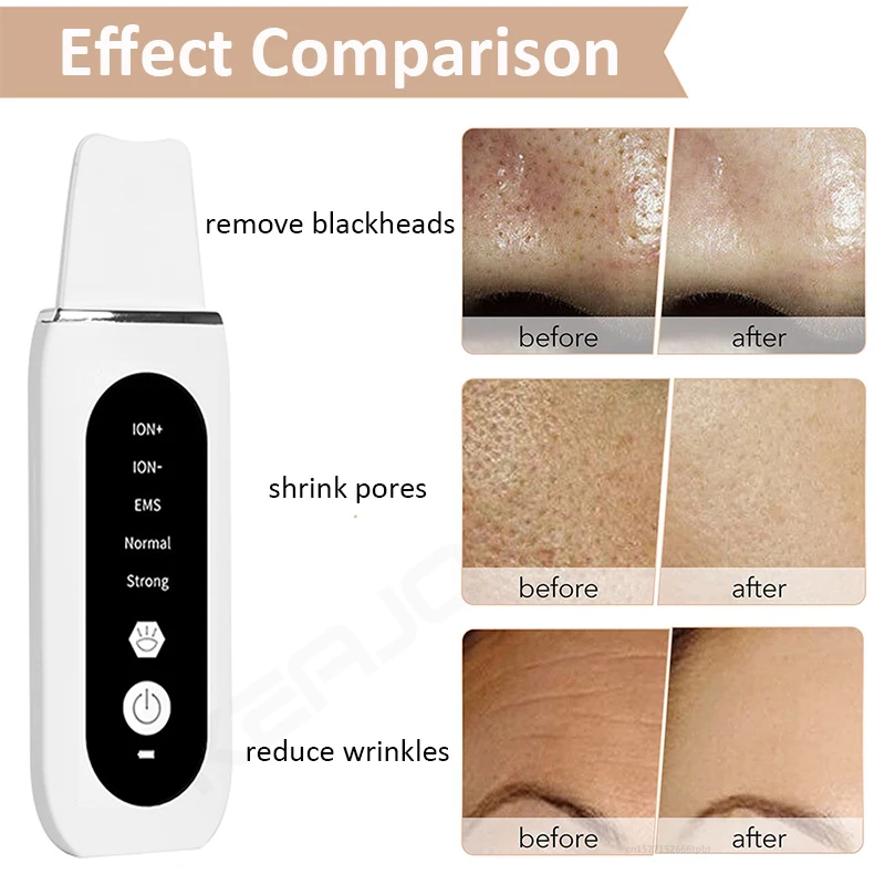 Ultrasonic Skin Scrubber Blackhead Remover Deep Face Cleaning Ultrasonic Cleaner Shovel Facial Peeling Cleaning Acne 26000hz