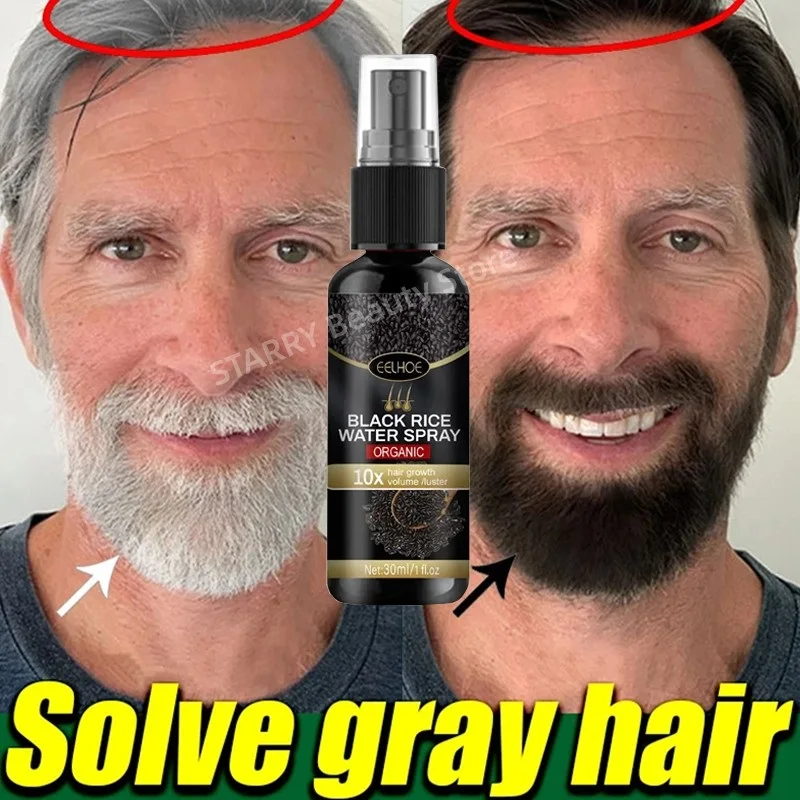 

Gray White Hair Treatment Serum White To Black Repair Natural Color Black Rice Nourish Spray Anti Loss Hair High Quality Product