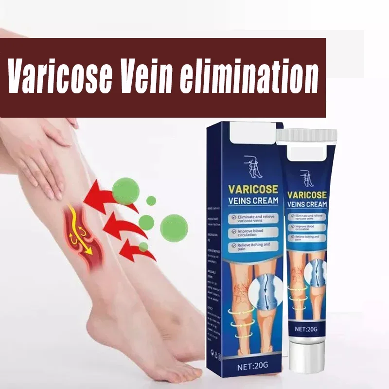 

Varicose vein 7 days Effective to Relieve Vasculitis Phlebitis Spider Pain Treatment ointment against varicose veins