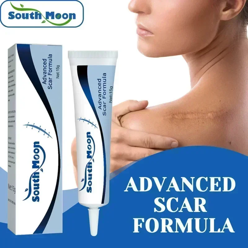 Scar Removal Cream Old Scar Cream Effective Repair New Scars Surgical Scars Stretch Marks Acne Pits Acne Marks Burn Scars