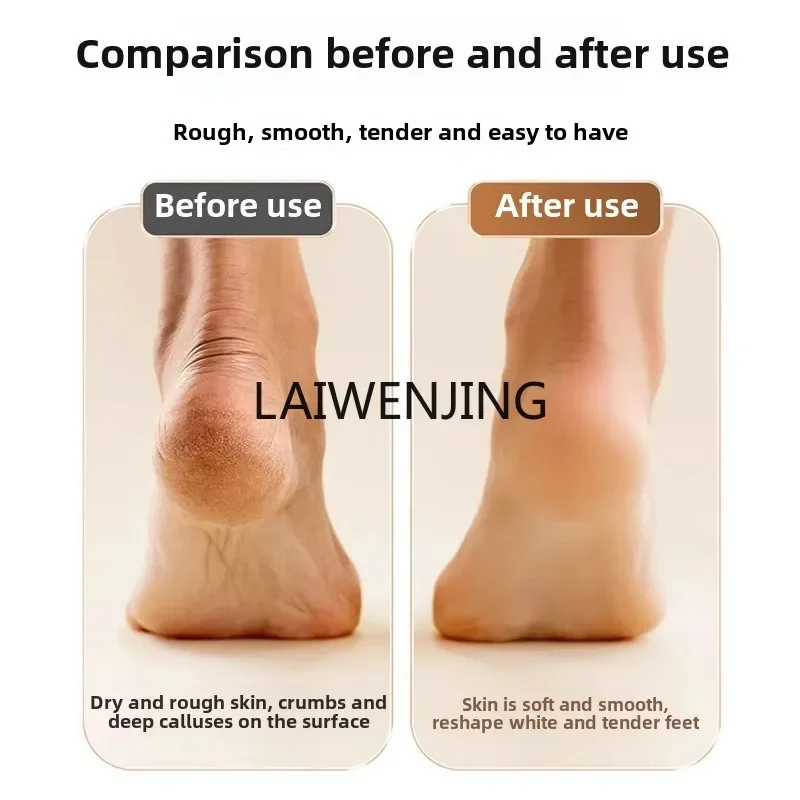 MJY Pedicure elettrico automatico Potente smerigliatrice per piedi per rimozione calli