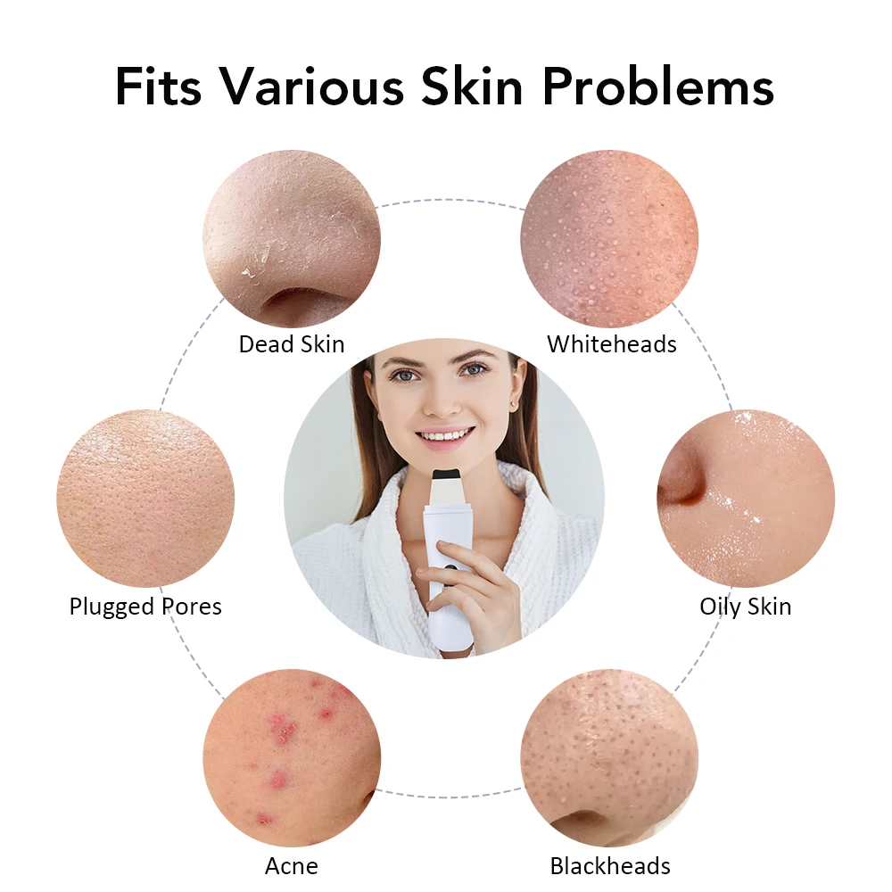 Scrubber ad ultrasuoni per la pelle Spatola per la pelle Pulizia profonda del viso agli ioni 4 modalità Lifting del viso Pulitore ad ultrasuoni Peeling Dispositivo per la cura della pelle