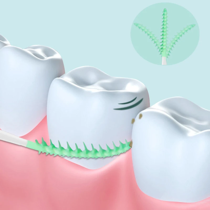 Cepillo Interdental de limpieza entre dientes, herramienta de higiene bucal, hilo Dental, ortodoncia, 30 piezas