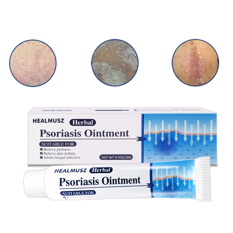 

1/2/3Pcs ZB Chinese Ointment Massage Psoriasi Eczema Cream Dermatitis Eczematoid Eczema Ointment Treatment Skin Care Cream