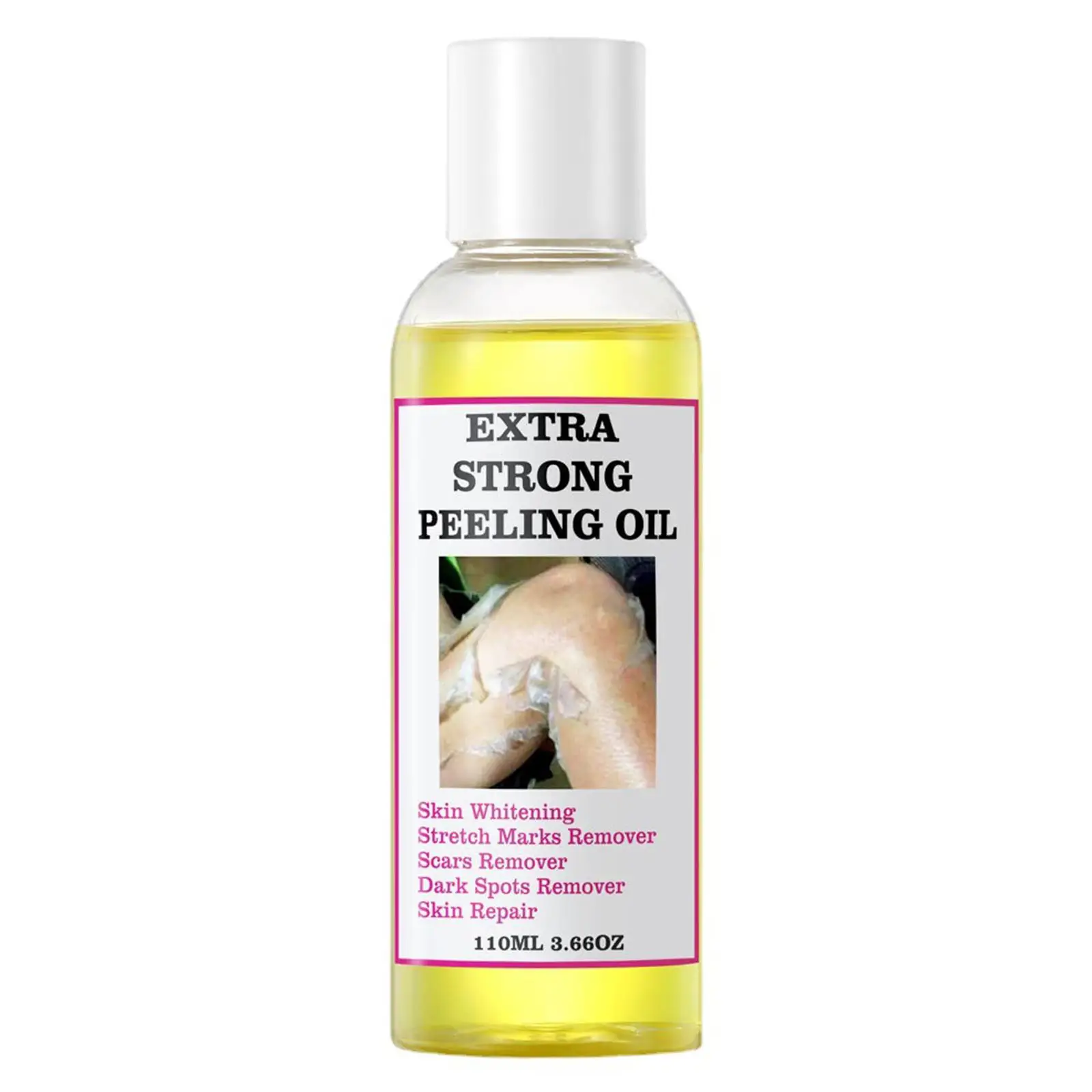 110ml Peeling Oil For Dark Skin Super Strength Yellow Peeling Oil Strong Peeling Oil For Skin Brightening Moisturizing Removes