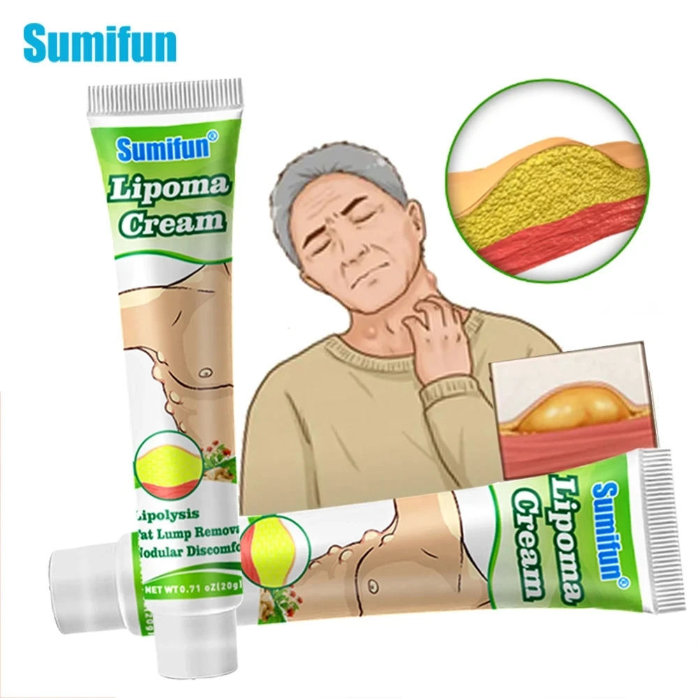 

20G Lipoma Removal Cream Lipolysis Fat Lump Relief Plaster Anti-Tumor Skin Swelling Pain Ointment Remove Cellulite Herbs Plaster