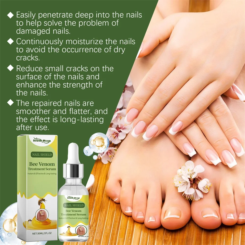 سائل تليين الأظافر لأظافر القدم السميكة، مصل إصلاح نمو الأظافر لجميع أنواع الأظافر
