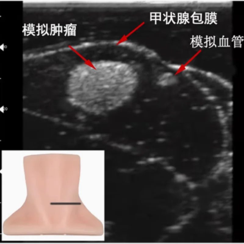 Ultrasound guided thyroid puncture module Ultrasound thyroid puncture biopsy model