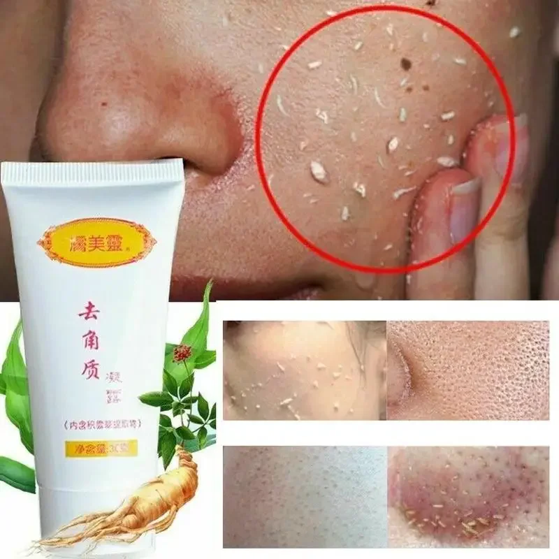 Scrub Ginger Exfoliating Gel Hyaluronic Acid Cleanser Nourishing Cleanser Moisturizing Face Wash Anti-spot Gel