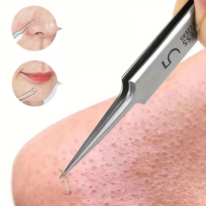 1/2/3/4/5/6set Extra Fine Cellular Acne Blackhead Tweezers - Facial Beauty Remove Acne Needle Tools For Skin Care