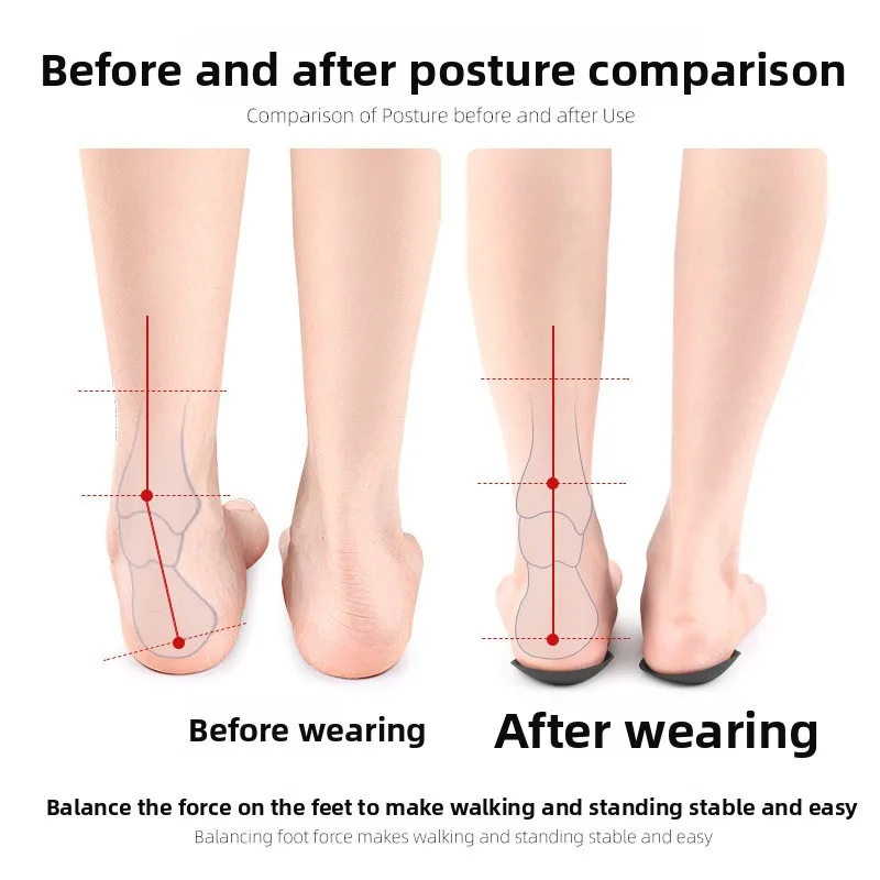 نصف وسادة على شكل قوس مغناطيسي، تدليك جسيمات، دعم قوس مسطح، وسادة مركزية للقدم، نعل داخلي وخارجي مثمن على شكل XO #3