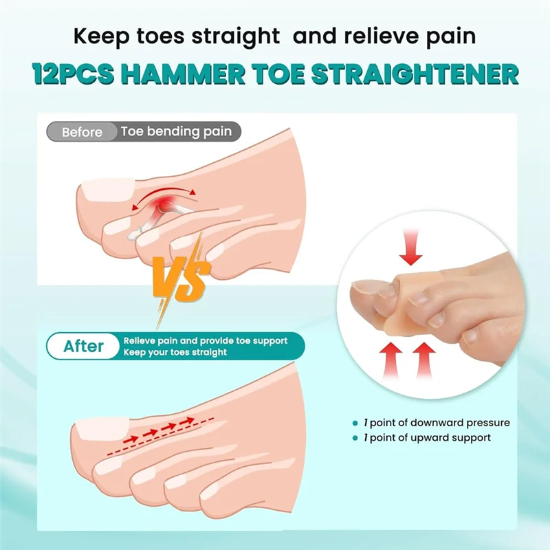 -ABUB Hamerteen Stijltang, 12 stuks Hamerteen Corrector voor dames en heren - 3 maten Siliconen teenmouwen Teenspalk