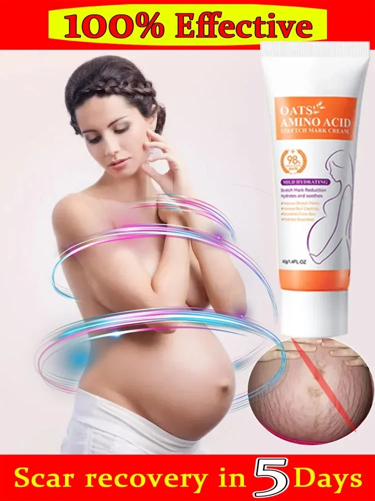 Stretch Mark Removal Cream Removes Stretch Marks Permanently Anti-Wrinkle Rejuvenates Skin