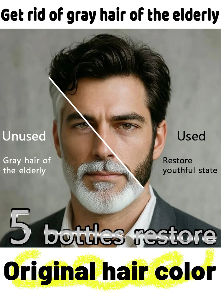 

Я не хочу белых волос. Я хочу мои черные волосы