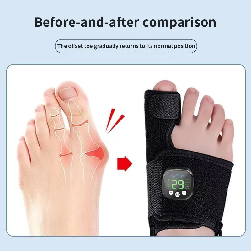 Elektrischer Hallux-Valgus-Korrektor, Zehenglätter mit TENS-Massage zur Schmerzlinderung, Fußpflege, orthopädisch – Detail 7