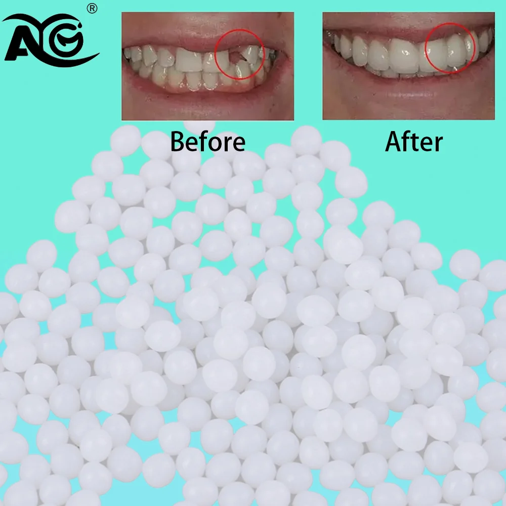 AG 15/25g Temporary Tooth Repair Kit And Gaps False Solid Glue Denture Adhesive Whitening Beauty Tool temporary tooth repair kit
