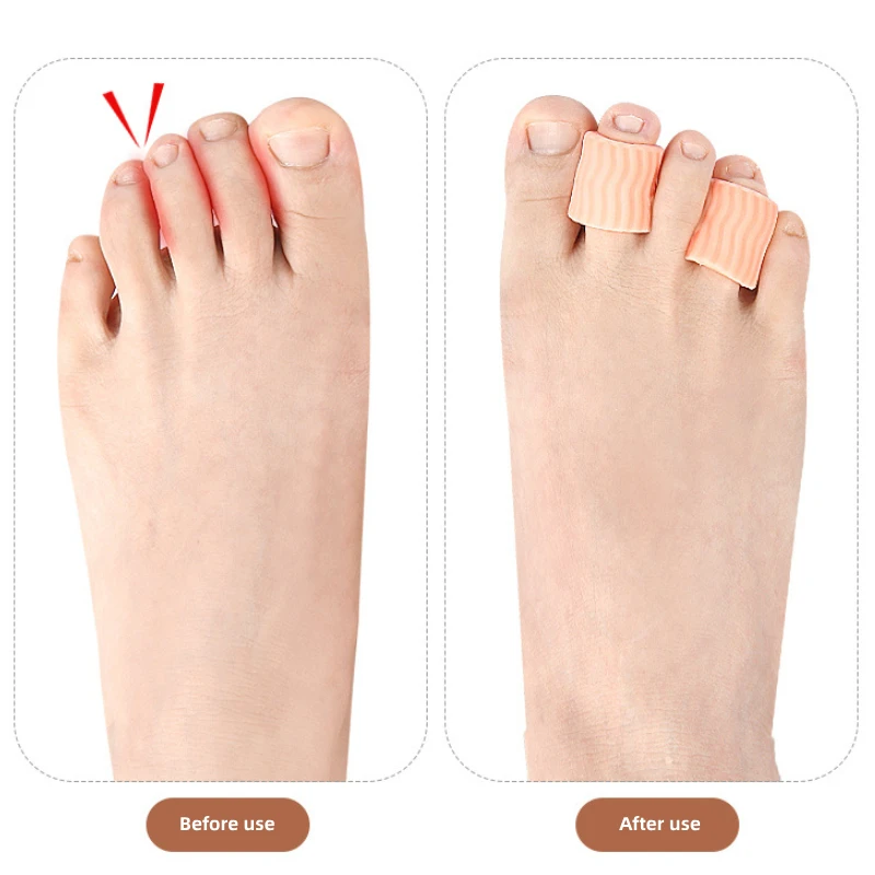 2Pcs=1Pair Gel Toe Separator Pinky Toe Spacers Little Toe Cushions for Preventing Rubbing Relieve Pressure Foot Care Tool