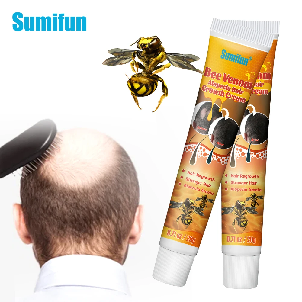 1/2/3Pcs Sumifun Hair Alopecia Growing Cream Baldness Regrowth Ointment Treat Grow Hairs Root Nourish Repair Health Plaster 20g