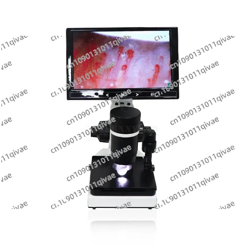 

SY-B198 Capillary Microscope With 9 Inch LCD Screen Nail Fold Capillaroscope