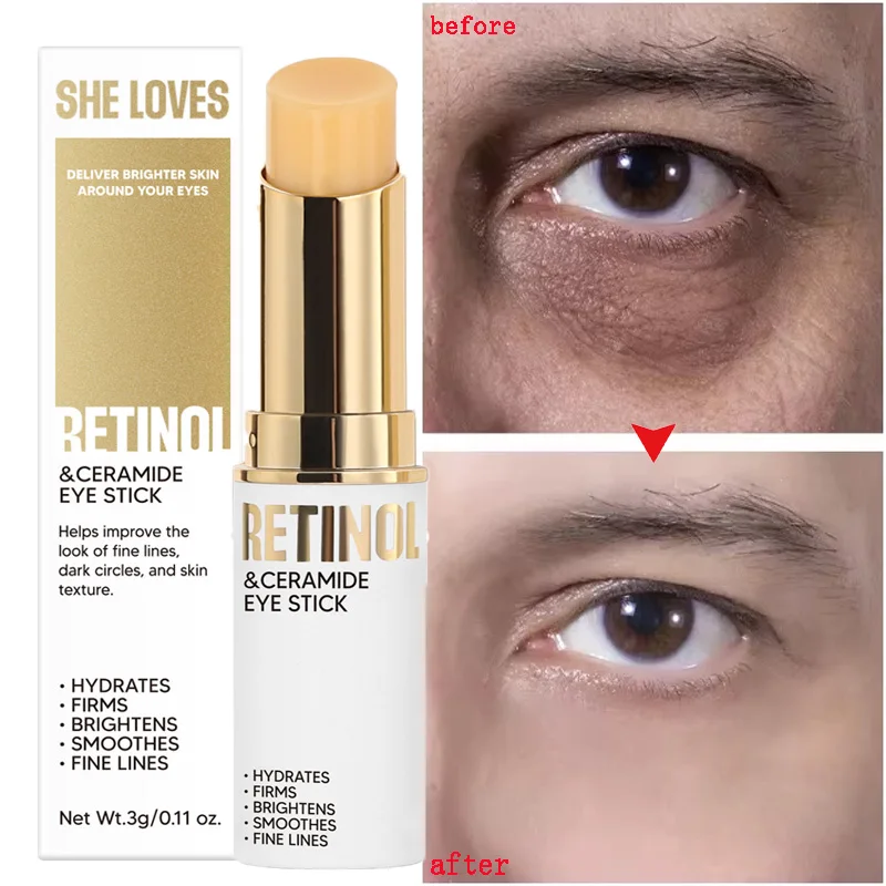 

Anti Dark Circles Eye Cream Retinol Anti Wrinkle Firming Skin Remove Eye Bag Fade Fine Lines Whitening Brighten Eye Care Korean