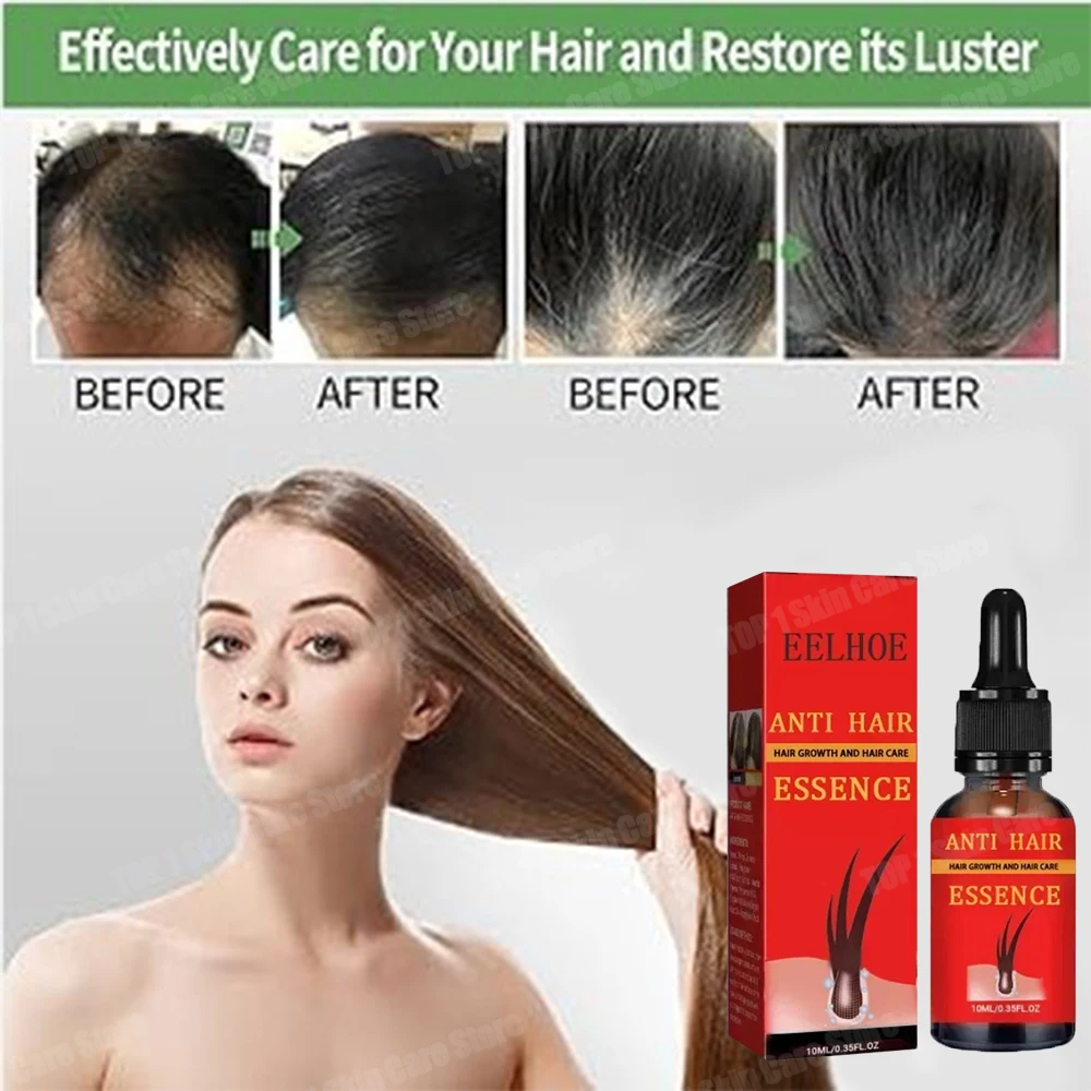 

Effective Fast Hair Growth Oil Baldness Repair Hereditary Hair Loss Postpartum HHair Seborrheic HHair Anti Loss 7 days