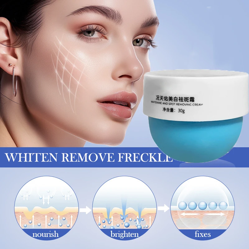 Отбеливающий крем от веснушек, удаление темных пятен, крем против веснушек, крем для лица, ниацинамид, выцветание пигментации, мелазма, осветляющий уход за кожей, 30 г