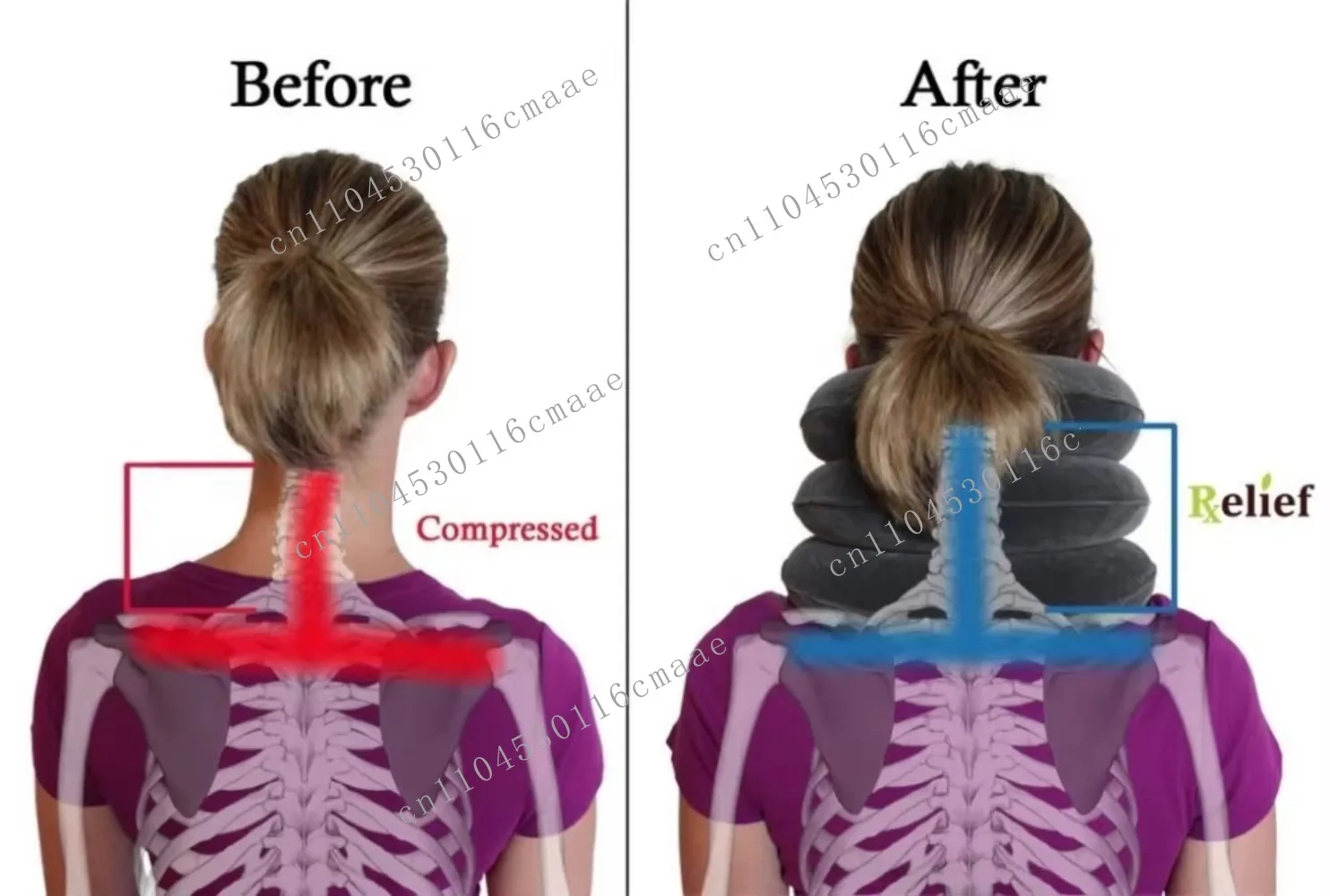 Inflatable Neck Pillow Effective and Instant Relief for Chronic Neck and Shoulder Pain