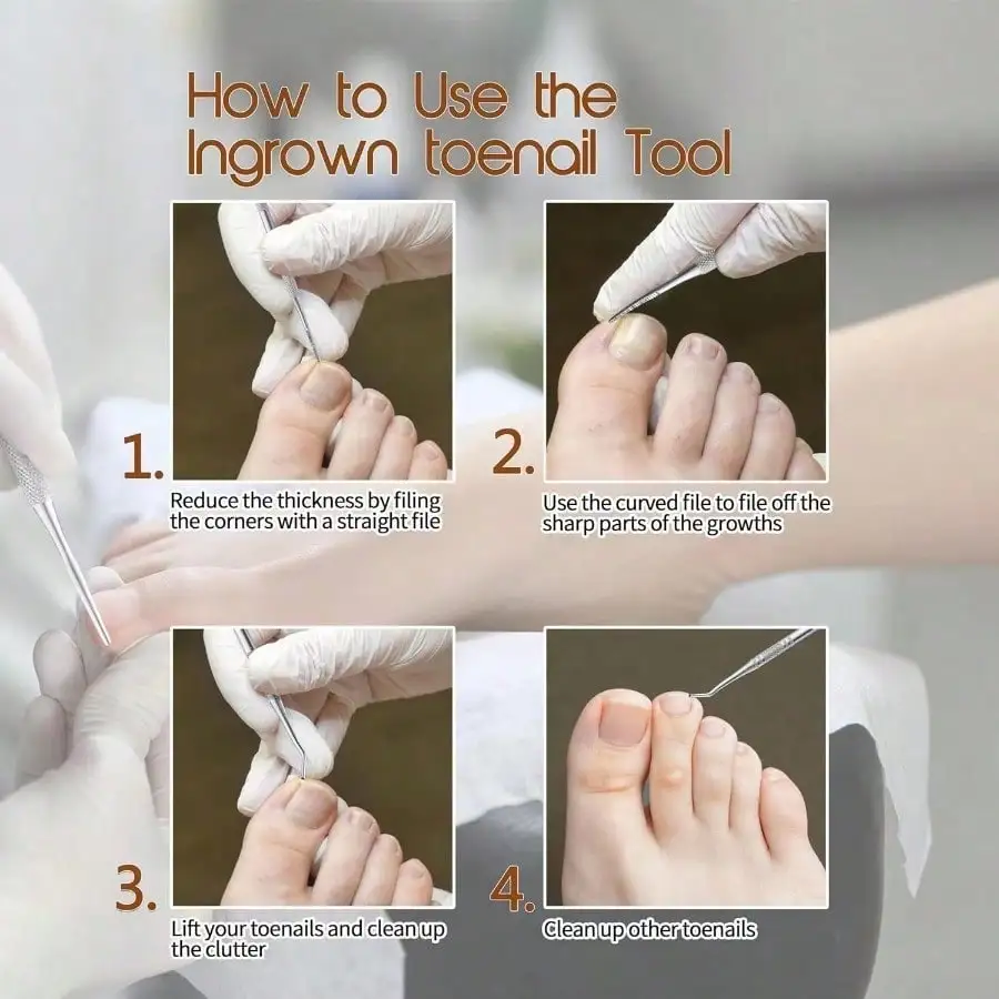 Strumento per la rimozione delle macchie delle unghie da 3 pezzi, lima per unghie multifunzionale, lima per pedicure, lima per bellezza, strumento per unghie incarnite, detergente per unghie per pedicure