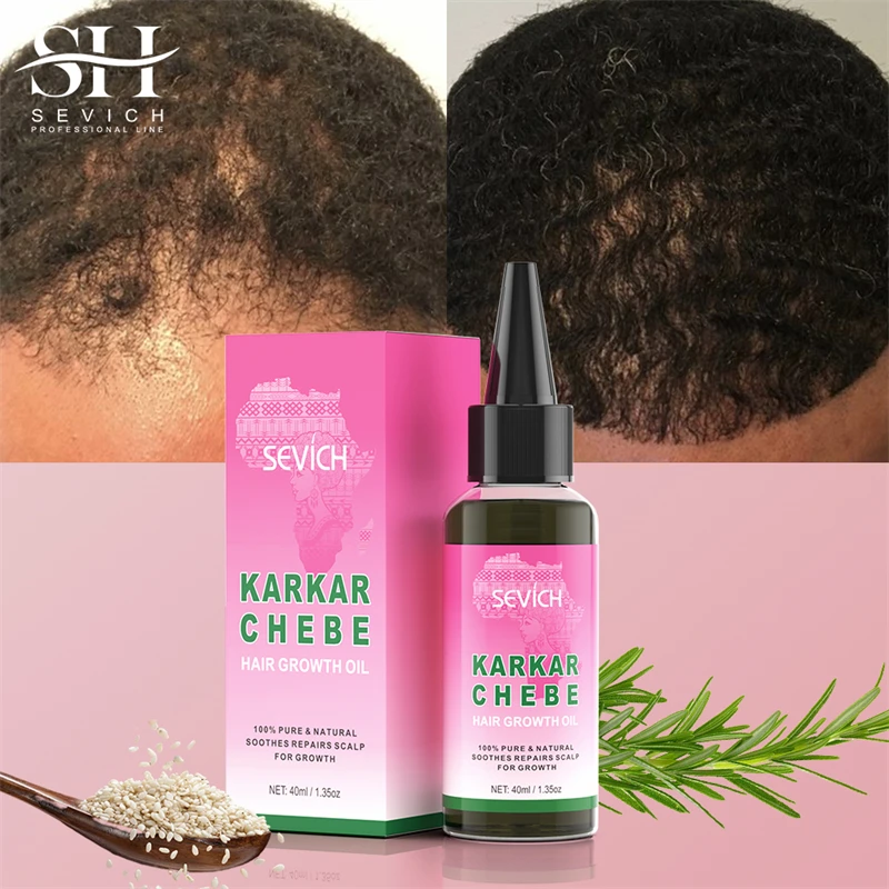 karkar Fast Hair Growth Sevich Traction Alopecia Hair Karkar Oil Anti Hair Break Hair Strengthen Hair Loss Care Repair Damage