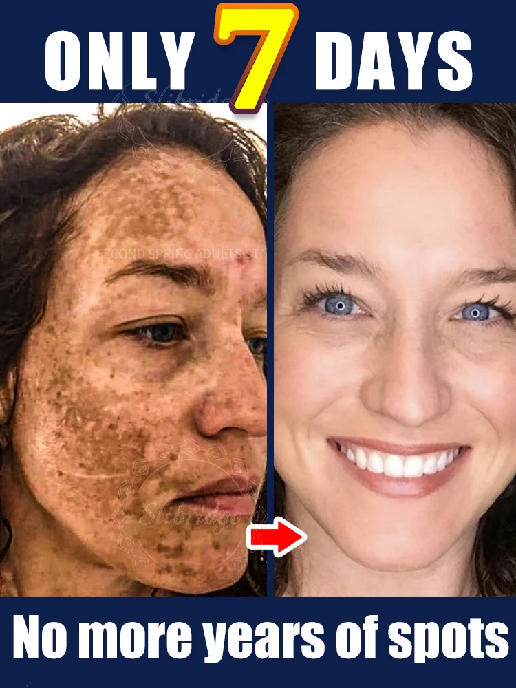 

Effectively lightens dark spots and restores facial skin Suitable for all ages