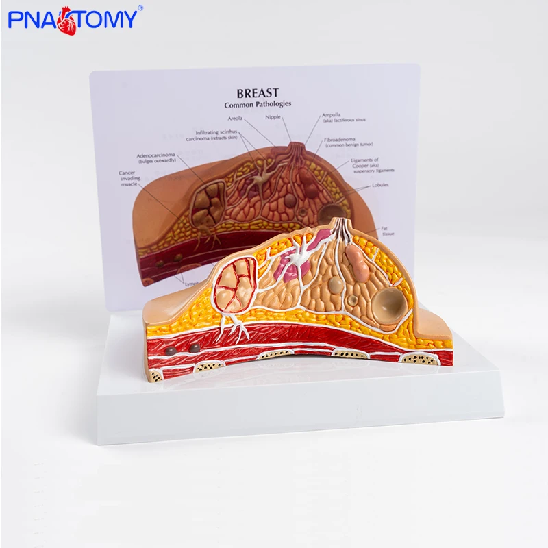 Breast Anatomy Model Teaching Aids Female Breast Structure Medical Beauty Salon Props Pathology Breast Dissection Teaching Gift