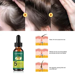 Óleo de Essência para o Crescimento do Cabelo Gengibre, Anti Queda de Cabelo, Prevenir o Tratamento da Calvície, Nutrir Rápido o Cuidado do Couro Cabelal, 5 Dias 10 principais vendas qual melhor tratamento para queda de cabelo - №9