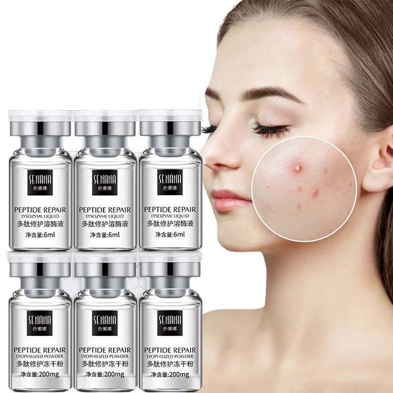 

Face Freeze-dried Powder Set Repair Acne Moisturizing Shrink Pores Oligopeptide Anti Wrinkle Skin Care Beauty Health