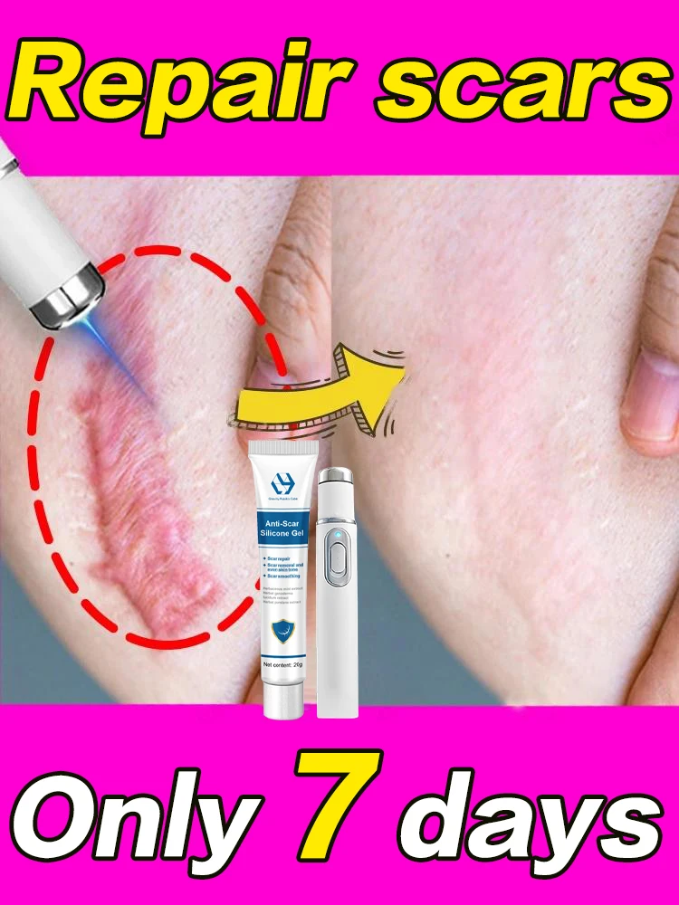 Painless Laser Removes Scars Blue Light Pen