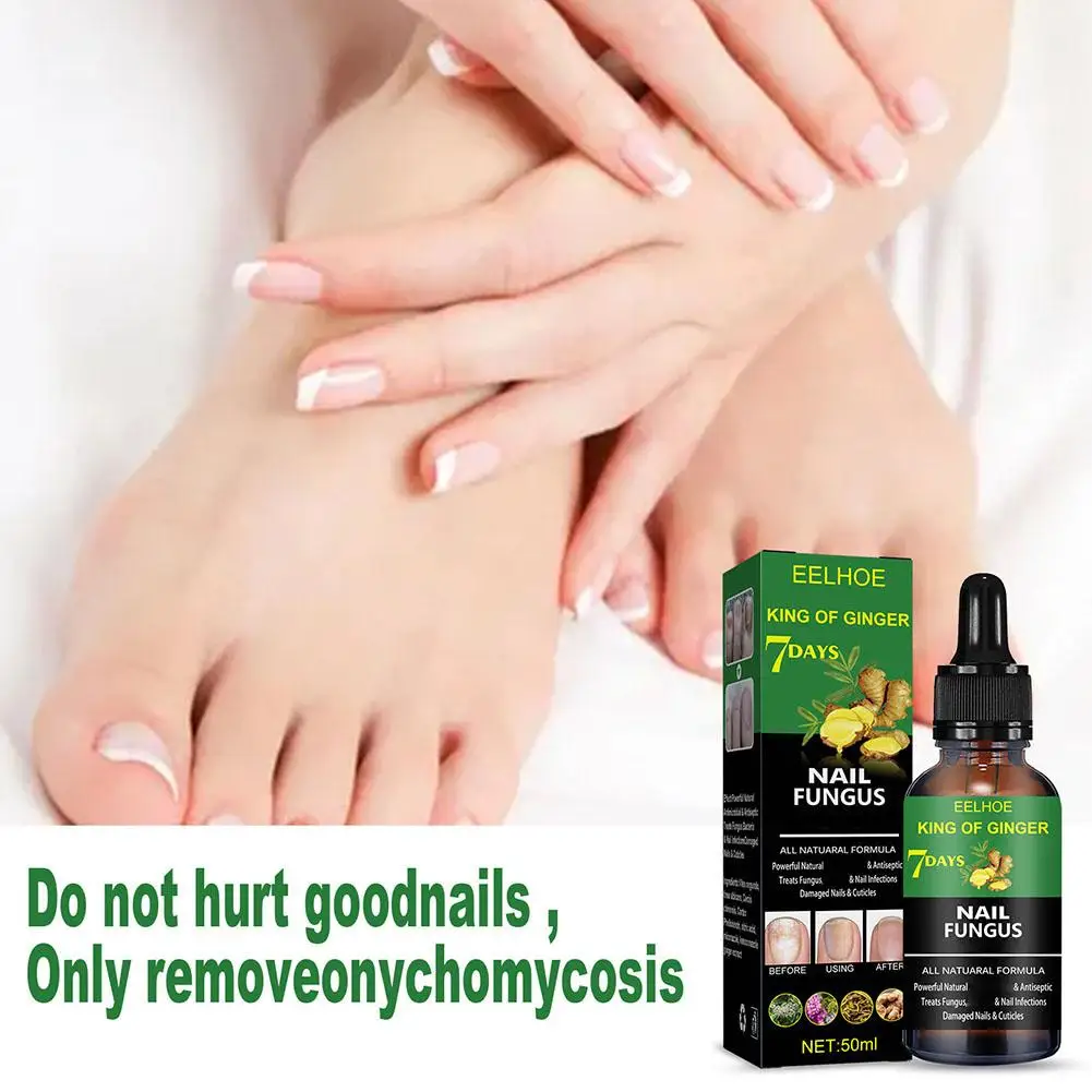 Nail Fungus Repair Liquid Anti-infective Paronychia Care Onychomycosis Fungal Removal Products Nails Health Nails 50ml V1F3