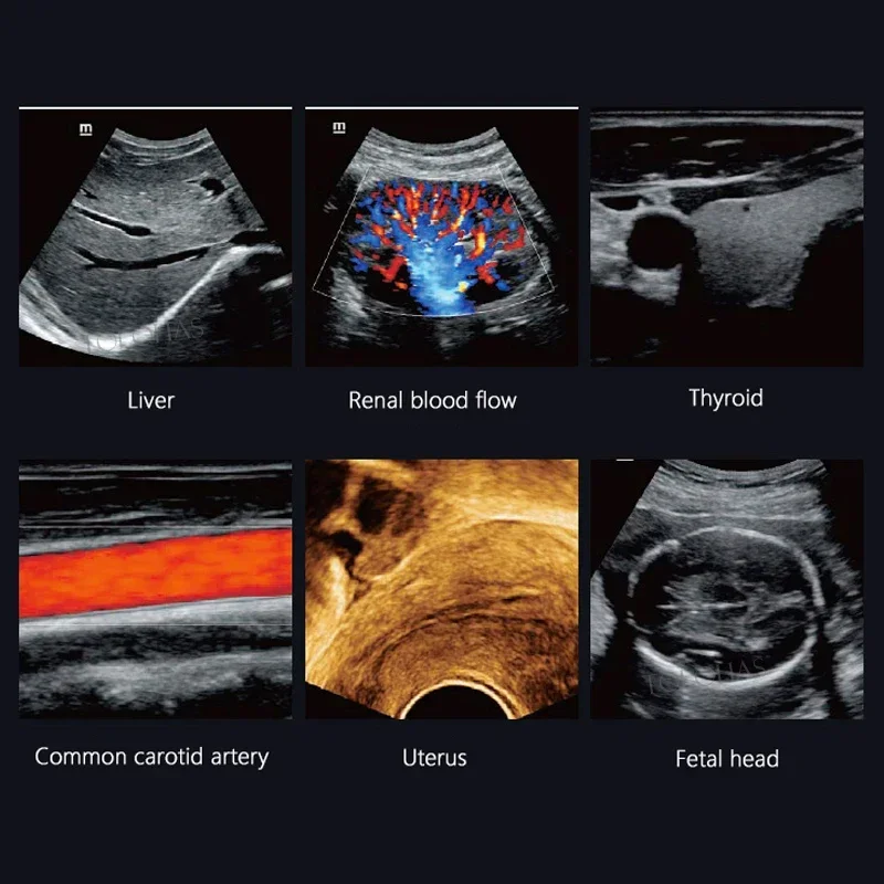 Mindray DC-26 trolley ultrasound equipement 4D USG ultrasonic color doppler machine