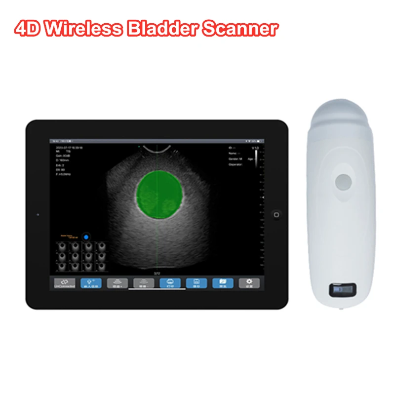 

Upgrade Handheld Wireless 4D Wireless Ultrasound Bladder Scanner