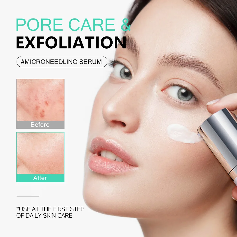 Cica Centella Micro-Needle Serum 50ml Exfoliating Smoothing Soothing Daily Facial Care for Rough Skin