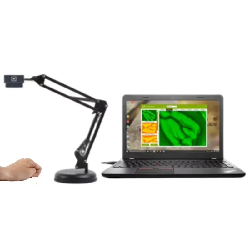 MC410 New generation upgraded portable infrared vein finder viewer with computer software and clear image