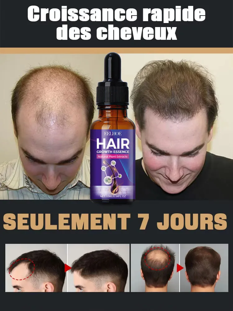 

99% of buyers buy again, have more and more hair, say goodbye to baldness, thick hair,Hot selling product