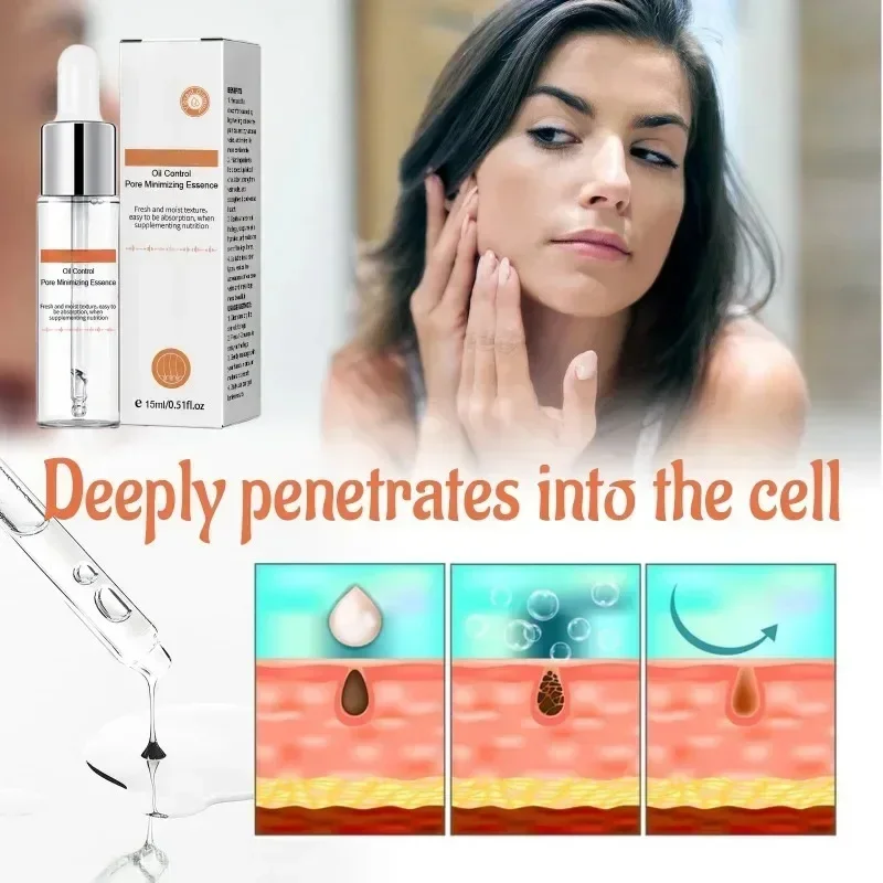 Pore Shrinking Serum Face Removing Large Pores Tightening Repairing Facial Pore Minimizing Essence Get Rid of Acne Marks 2024